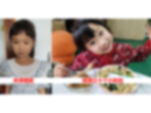 小儿过敏体质调理案例