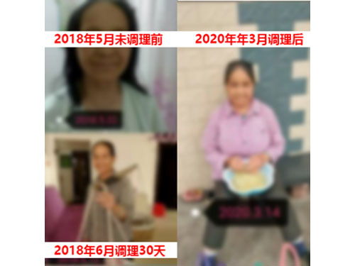 风湿调理案例