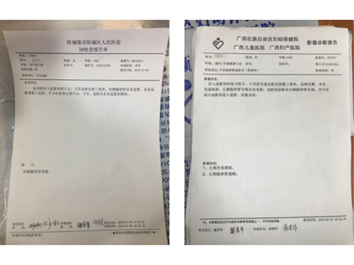 妇科输卵管堵塞调理案例