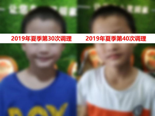 癫痫臟腑调理案例
