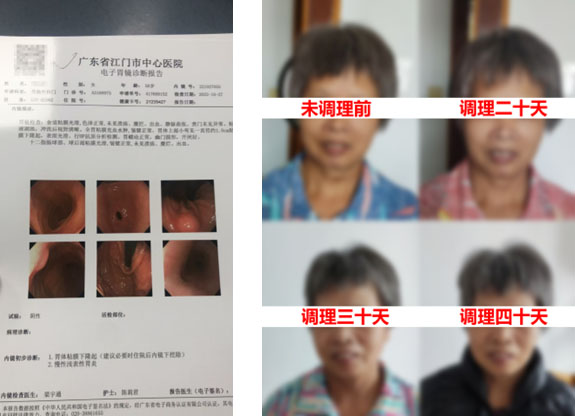 臟腑调理,金桂堂,健康馆,慢性胃炎