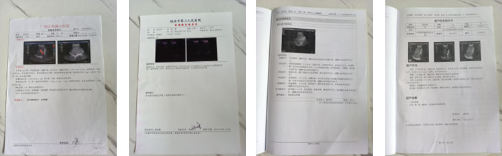 脏腑按摩,脏腑推拿,血管瘤,调理,心脑血管
