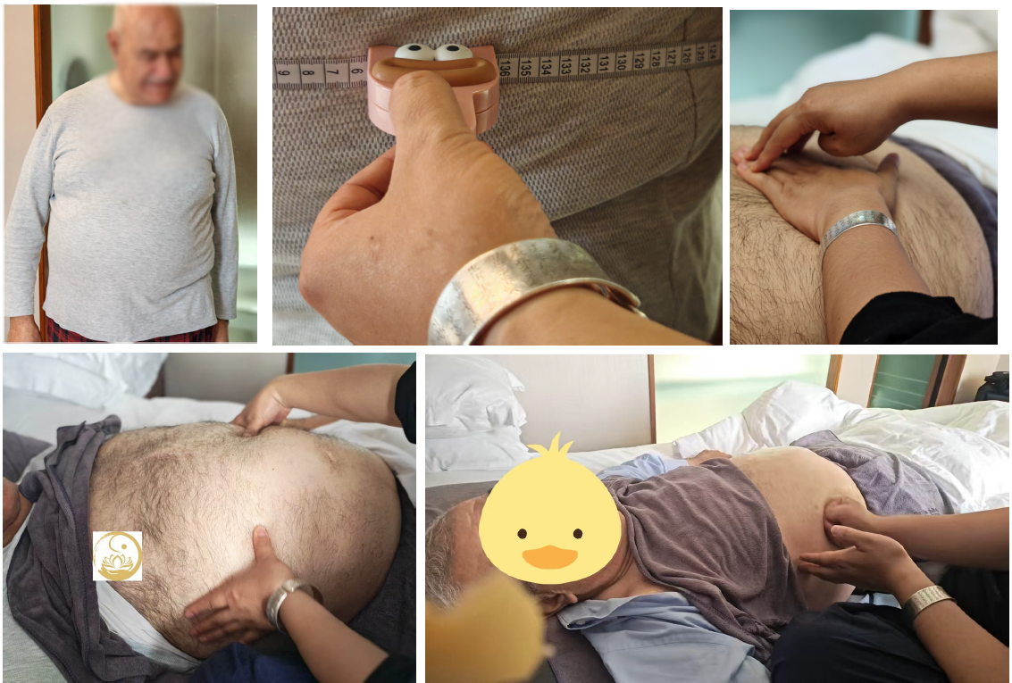 臟腑调理,脏腑调理,肥胖,减脂